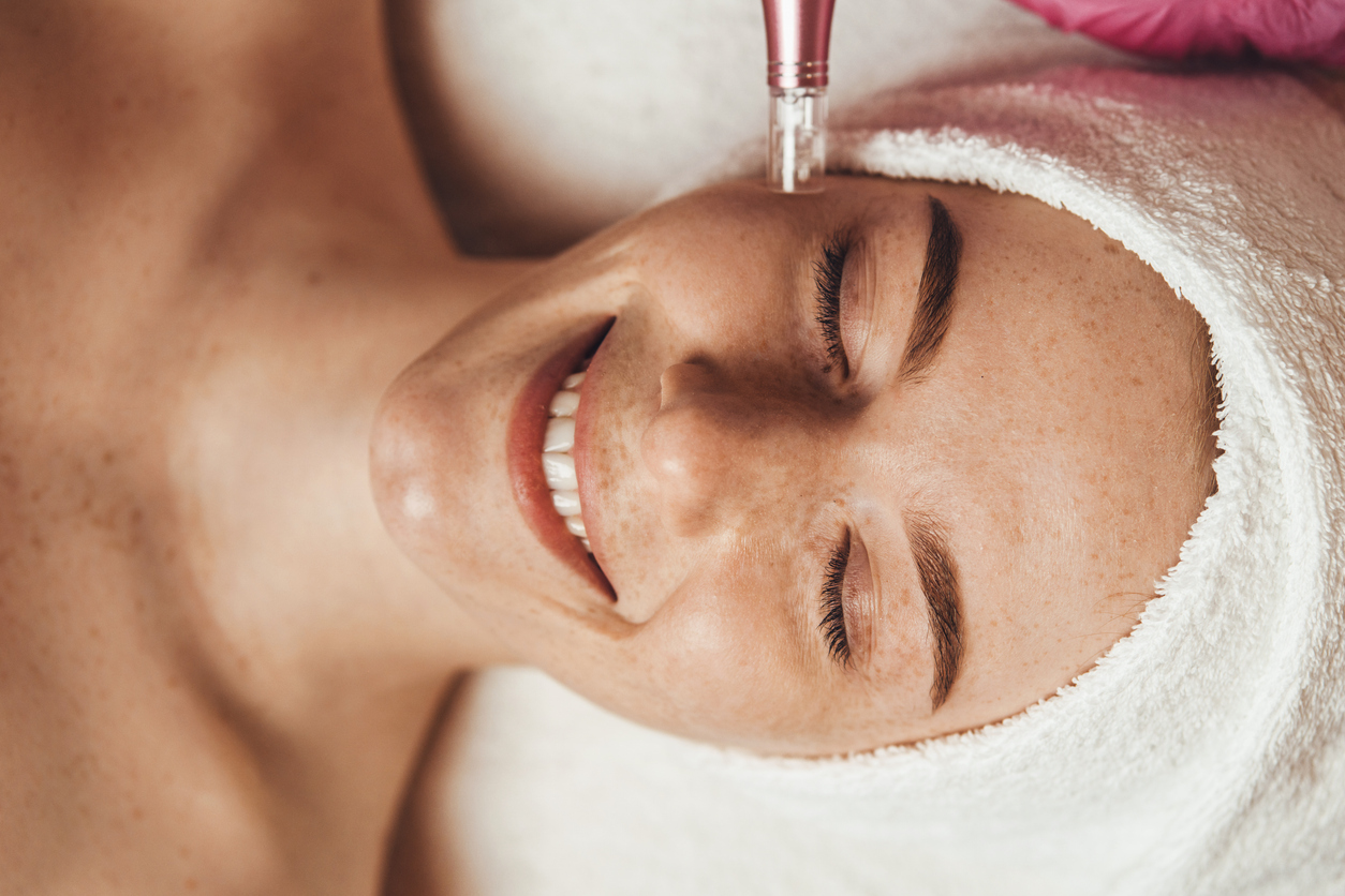 Featured image for Benefits of Microneedling