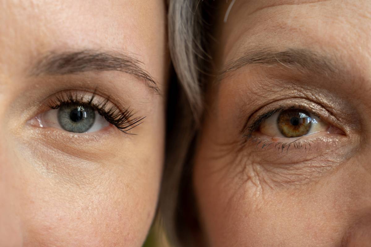 Featured image for Who Is an Ideal Candidate for Upper Eyelid Surgery